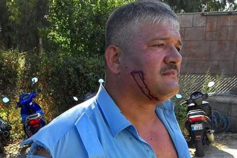 Zabıta’ya Dayak Şoku